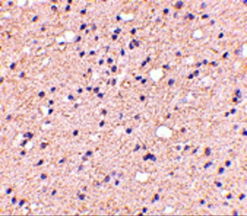 ELOVL6 Antibody