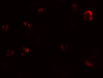 KIAA1324 Antibody