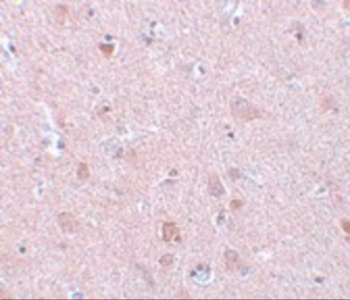 EFHD2 Antibody