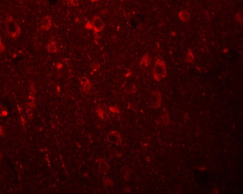 EFHD2 Antibody