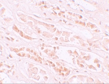 EFCAB4B Antibody