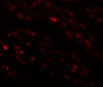 EFCAB4B Antibody