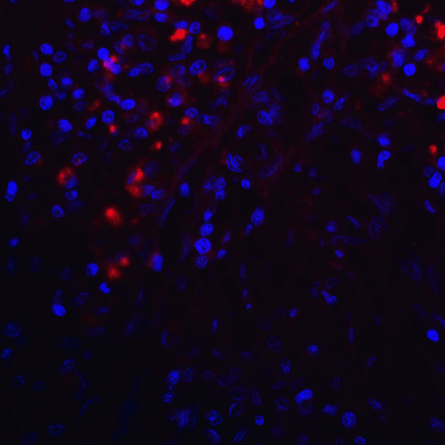 CD274 Antibody