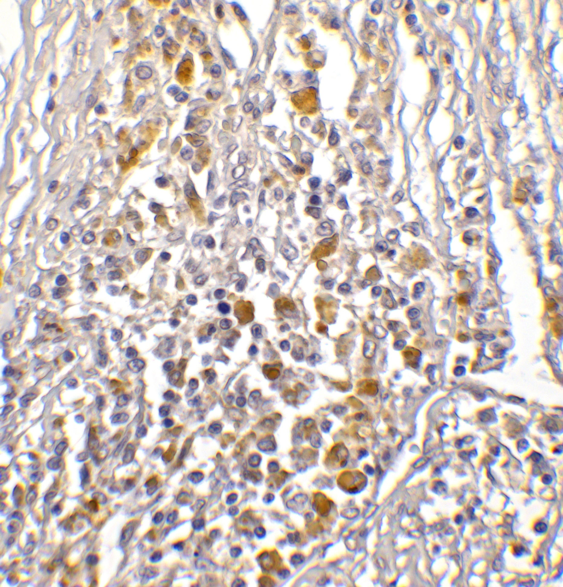 CD274 Antibody