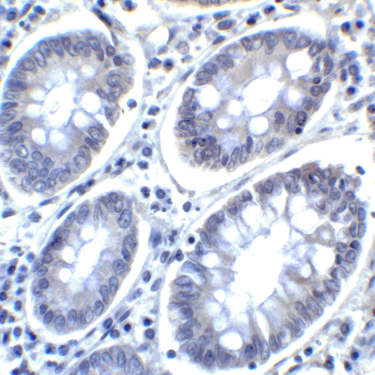 PDL2 Antibody [4E10]