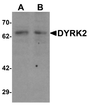 DYRK2 Antibody