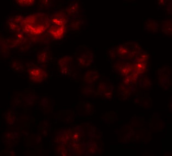 DYRK2 Antibody