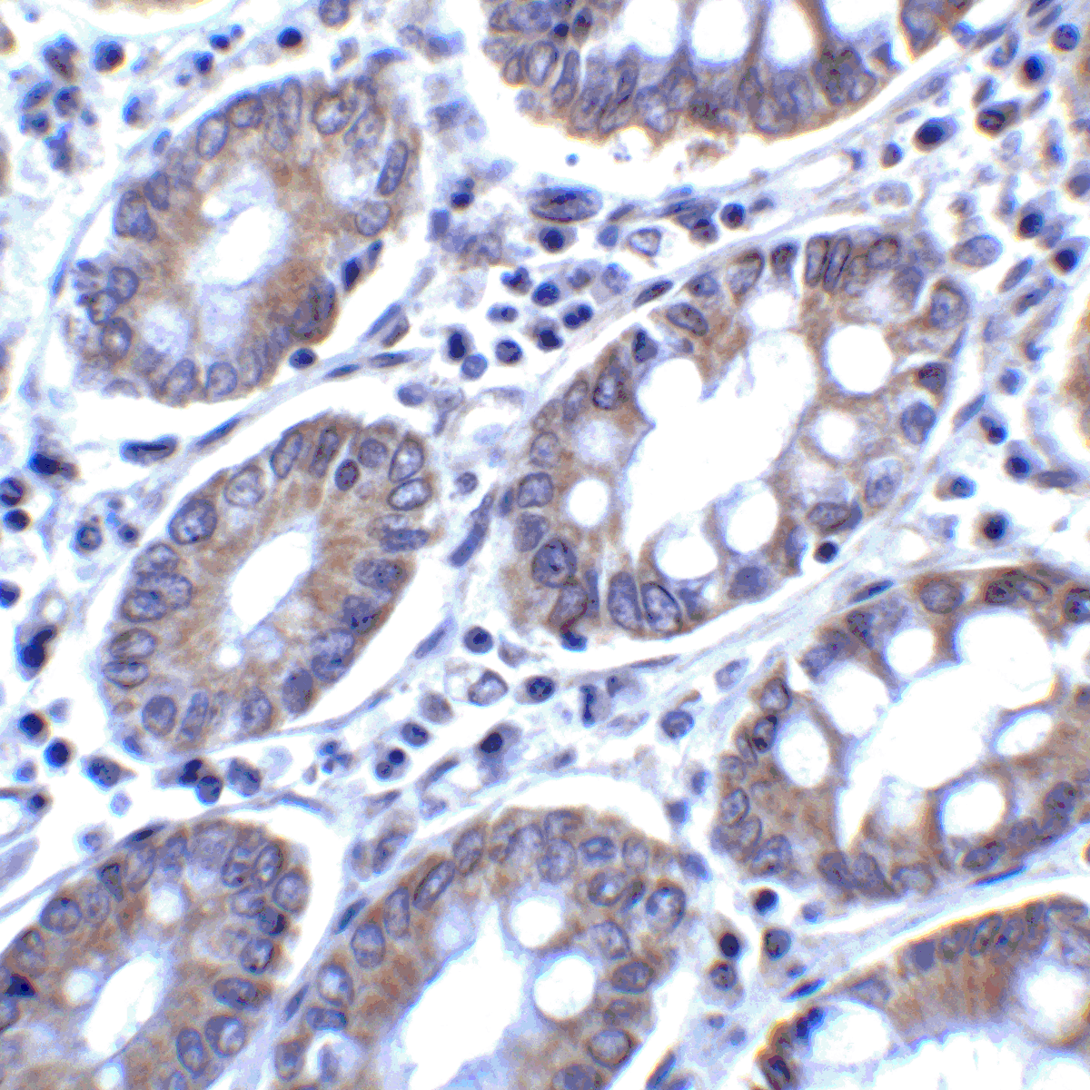 PDCD1LG2 Antibody