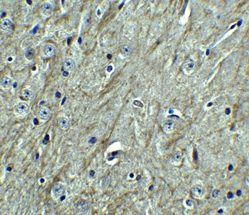 PD-L2 Antibody