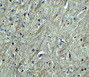 PDCD1LG2 Antibody