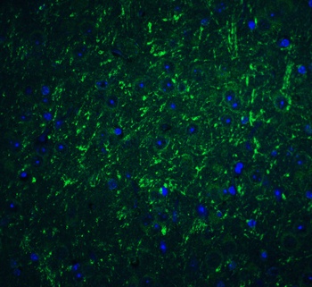 PD-L2 Antibody