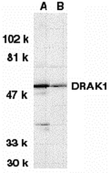 DRAK1 Antibody