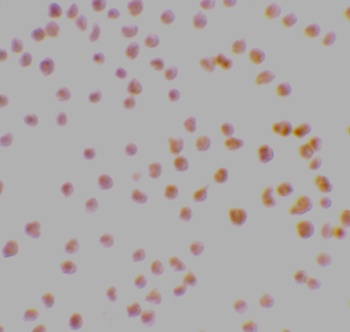 DRAK1 Antibody