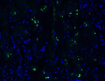 PGAM5 (CT) Antibody