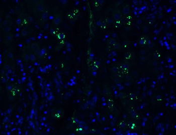 PGAM5 Antibody