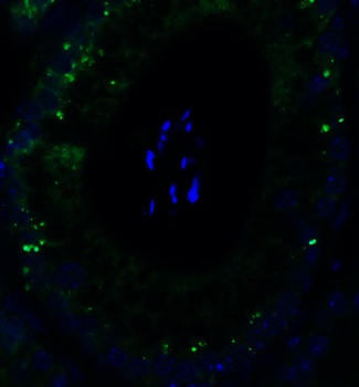 PGAM5 (CT) Antibody