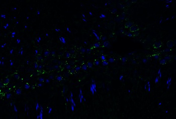 PGAM5 (CT) Antibody