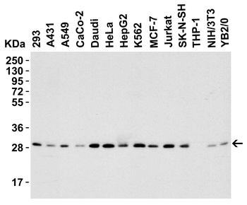 ANP32A Antibody