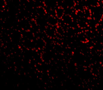 PHAP I Antibody