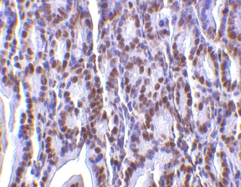 ANP32A Antibody