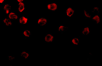 DOK1 Antibody