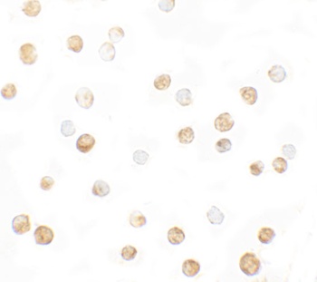 DNM1L Antibody