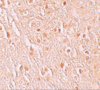 PION Antibody