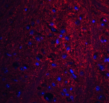 PION Antibody