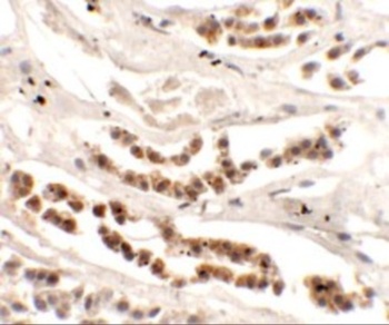 DISP1 Antibody