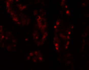 DISP1 Antibody