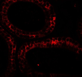 DIS3 Antibody