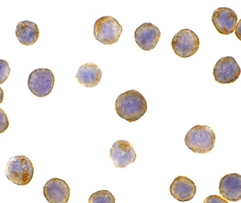DFFA Antibody