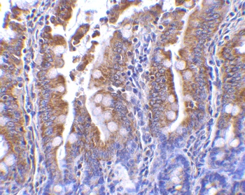 GOPC Antibody