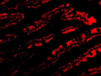 PIST Antibody