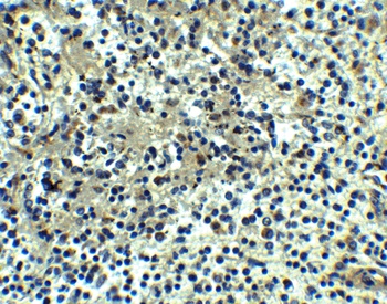 DEPDC1B Antibody