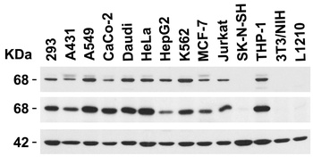 EIF2AK2 Antibody