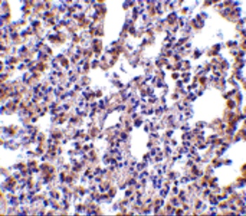 EIF2AK2 Antibody