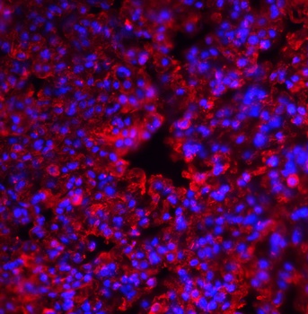 EIF2AK2 Antibody