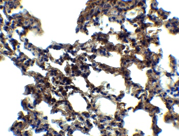 EIF2AK2 Antibody