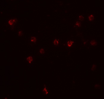 DDX60 Antibody