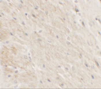 DDX41 Antibody