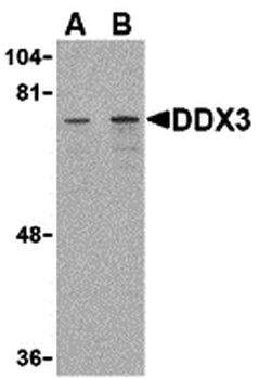DDX3X Antibody