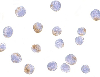 DDX3X Antibody