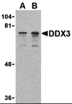 DDX3X Antibody
