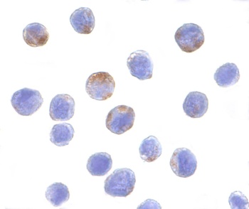 DDX3X Antibody