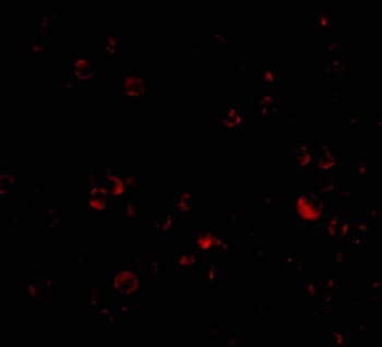 DDX3X Antibody