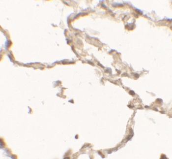 DDC Antibody