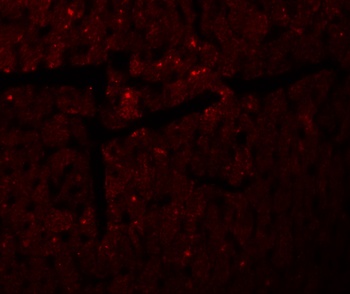 DDA Antibody