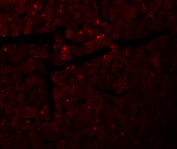 DDA1 Antibody