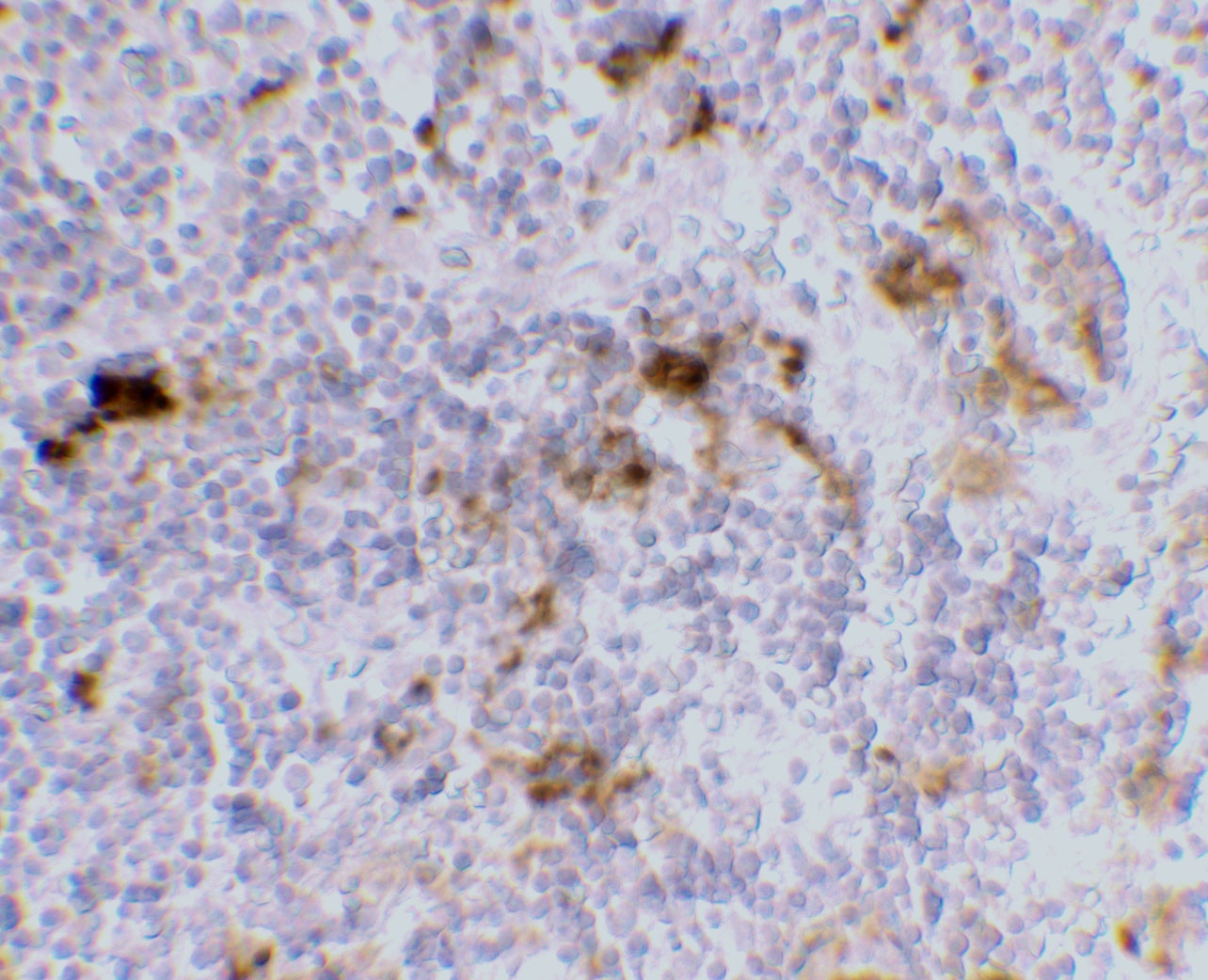 CD209 Antibody